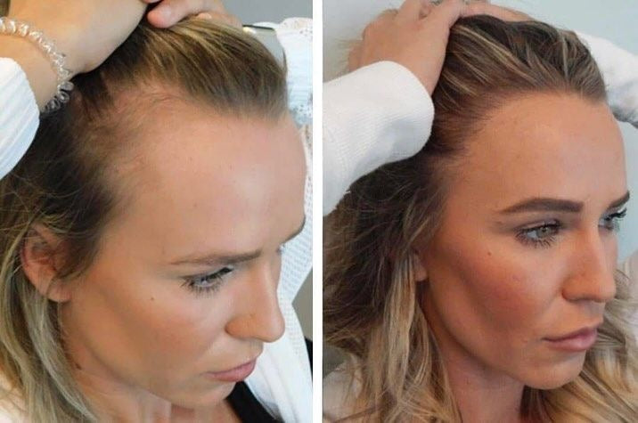 Capelli Scalp Serum