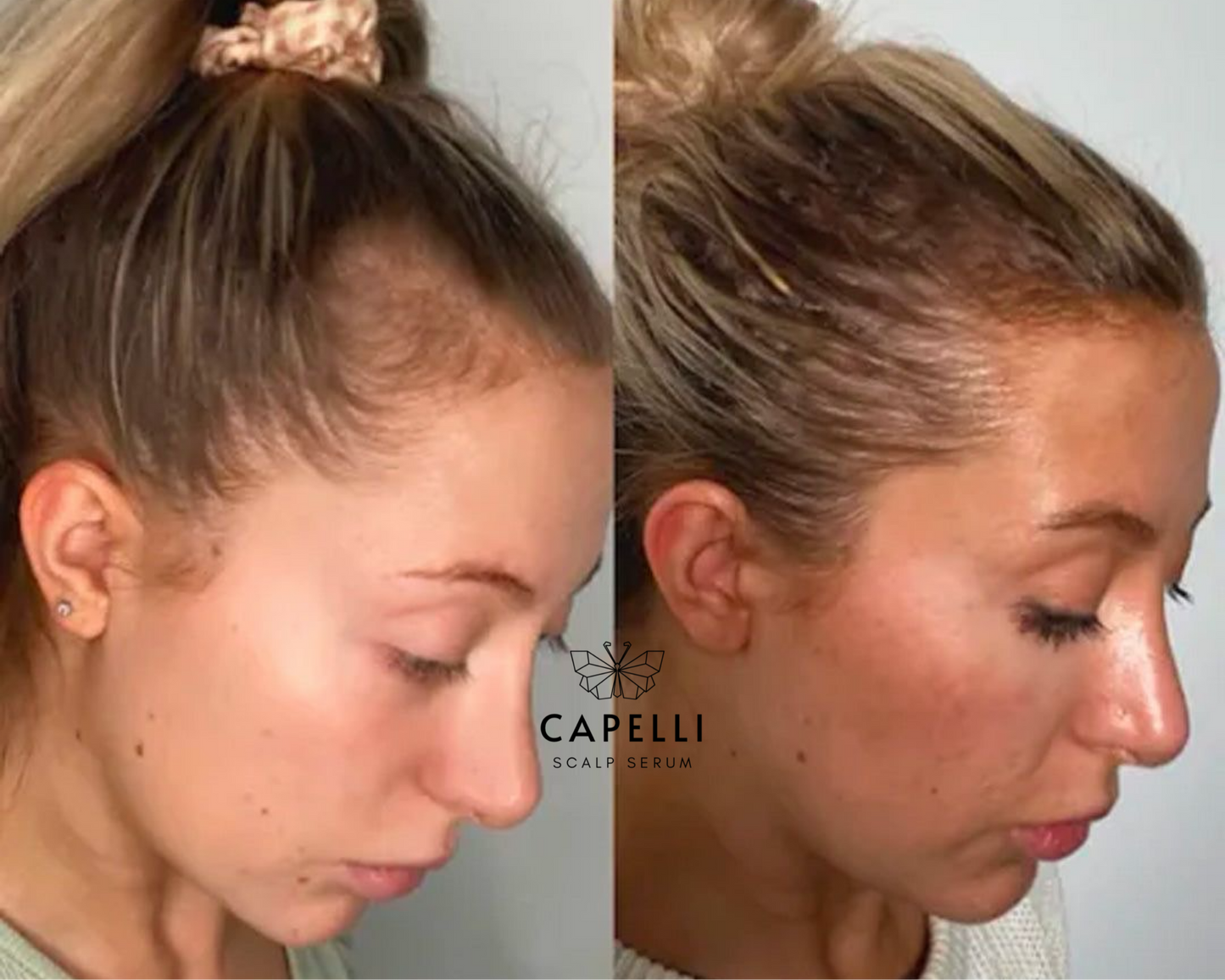Capelli Scalp Serum